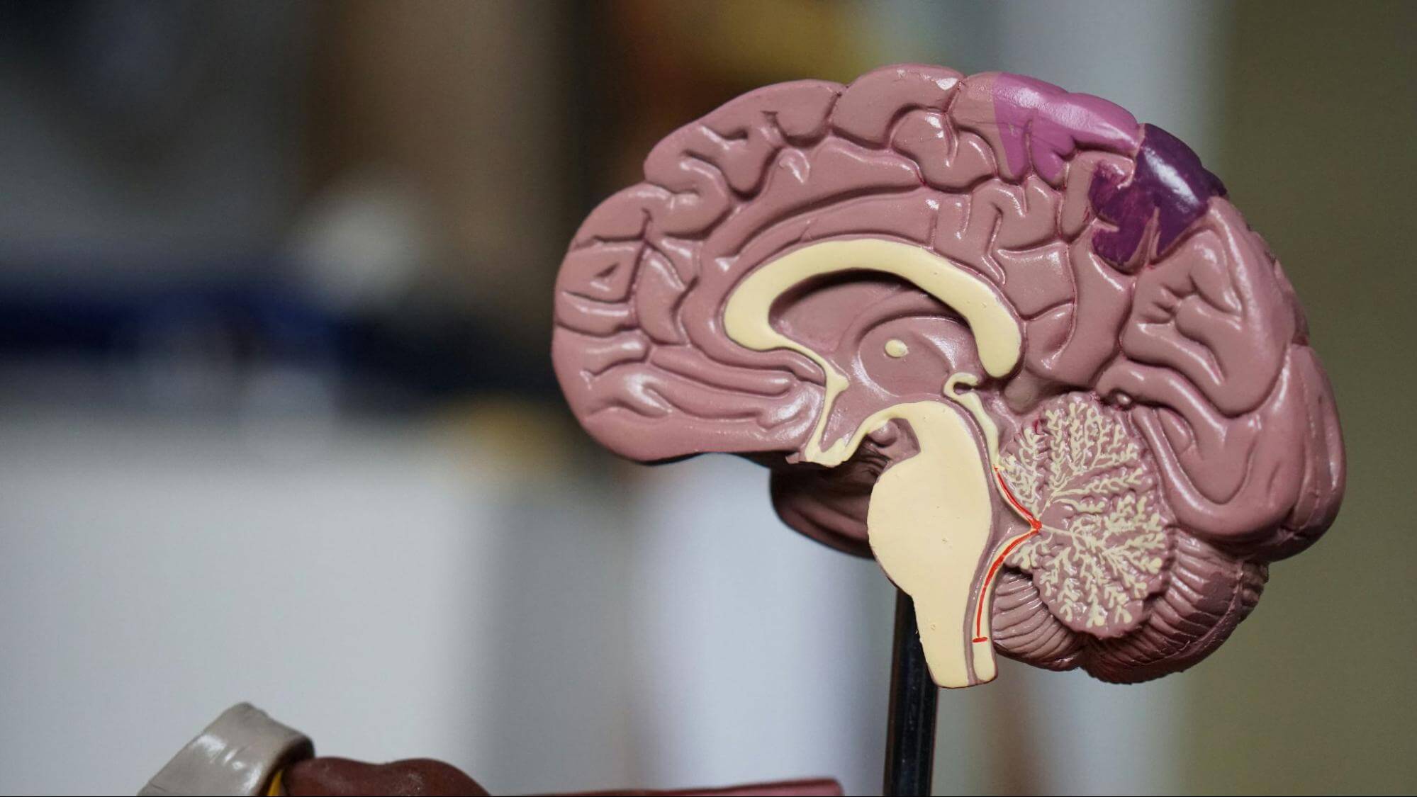 The Impacts of Medicalization on Mental Health Stigma